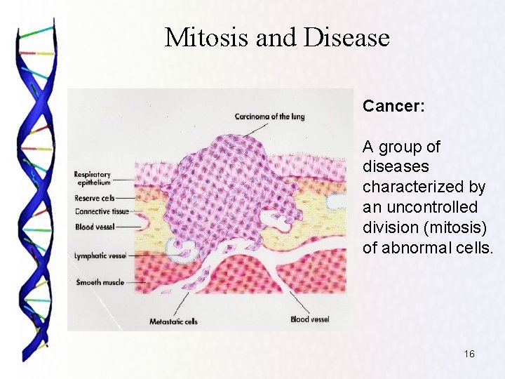 Mitosis and Disease Cancer: A group of diseases characterized by an uncontrolled division (mitosis)