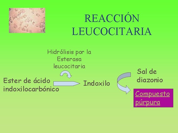 REACCIÓN LEUCOCITARIA Hidrólisis por la Esterasa leucocitaria Ester de ácido indoxilocarbónico Indoxilo Sal de