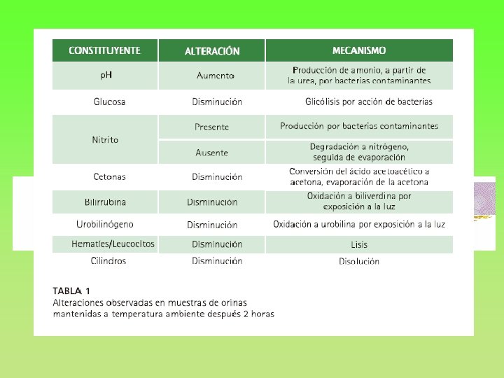 CARACTERISTICAS MUESTRA DE ORINA - Composición sometida a múltiples variaciones (ppal vehículo de excreción)