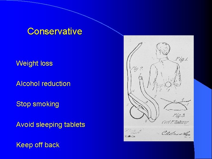 Conservative Weight loss Alcohol reduction Stop smoking Avoid sleeping tablets Keep off back Conservative Weight loss Alcohol reduction Stop smoking Avoid sleeping tablets Keep off back