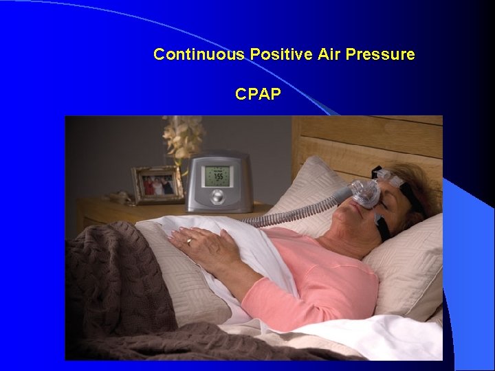 Continuous Positive Air Pressure CPAP Continuous Positive Air Pressure CPAP