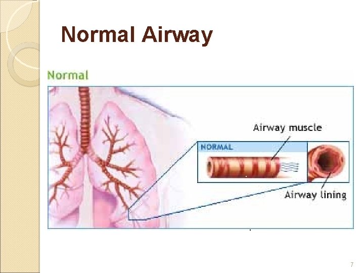 Normal Airway 7 