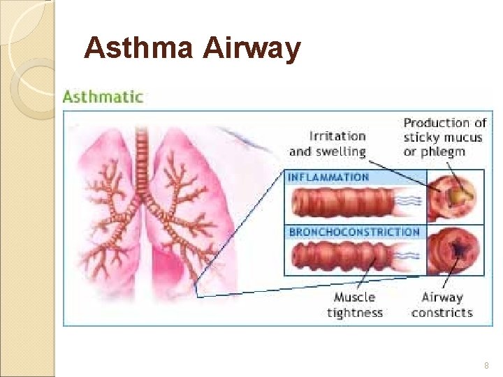 Asthma Airway 8 