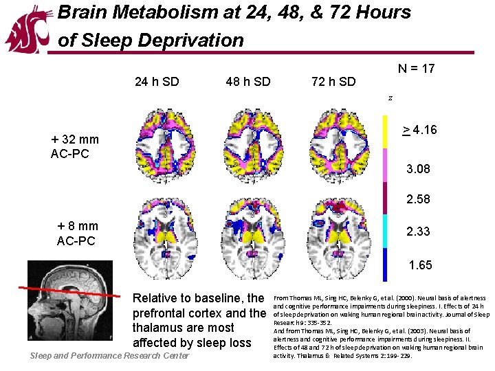 Brain Metabolism at 24, 48, & 72 Hours of Sleep Deprivation 24 h SD