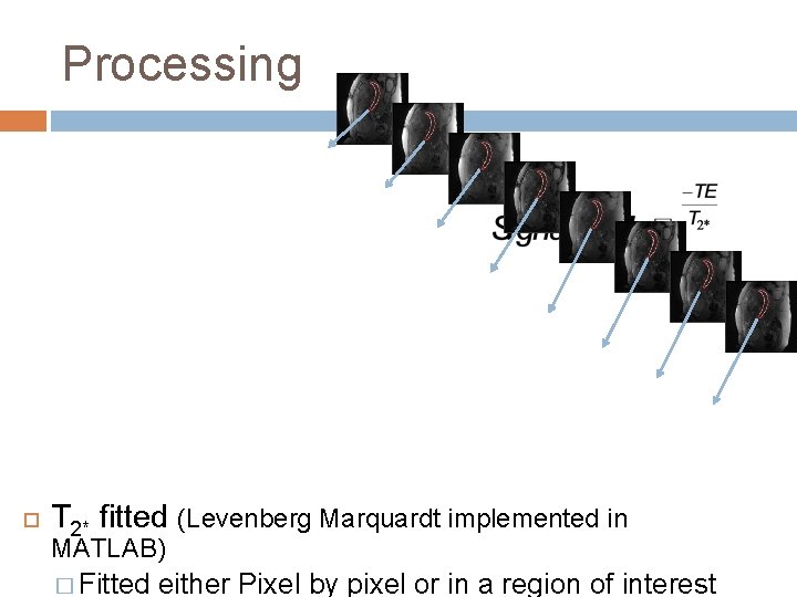 Processing T 2* fitted (Levenberg Marquardt implemented in MATLAB) � Fitted either Pixel by Processing T 2* fitted (Levenberg Marquardt implemented in MATLAB) � Fitted either Pixel by
