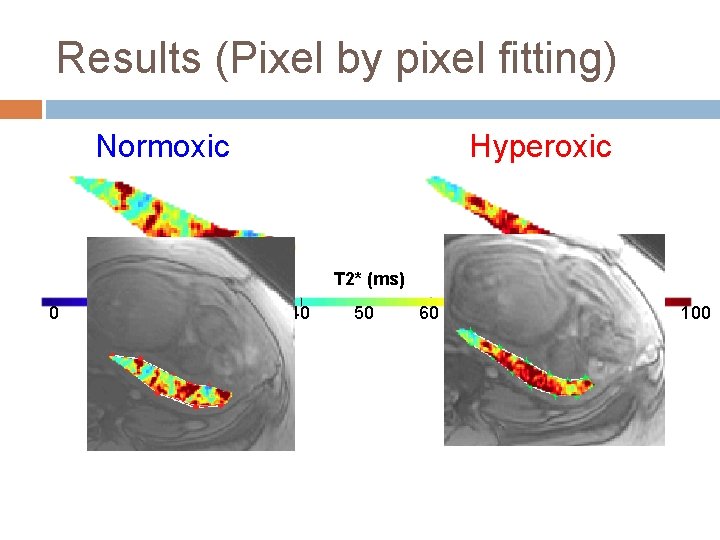 Results (Pixel by pixel fitting) Normoxic Hyperoxic T 2* (ms) 0 10 20 30 Results (Pixel by pixel fitting) Normoxic Hyperoxic T 2* (ms) 0 10 20 30