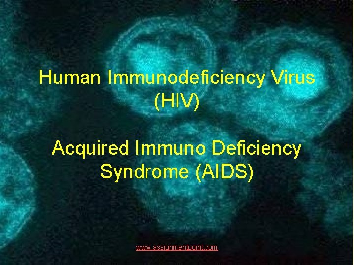 Human Immunodeficiency Virus (HIV) Acquired Immuno Deficiency Syndrome (AIDS) www. assignmentpoint. com 