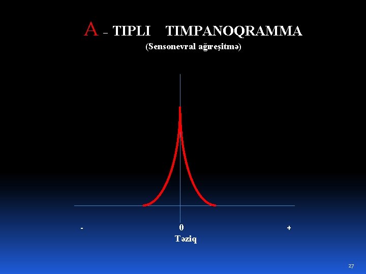 A – TIPLI TIMPANOQRAMMA (Sensonevral ağıreşitmə) - 0 Təziq + 27 