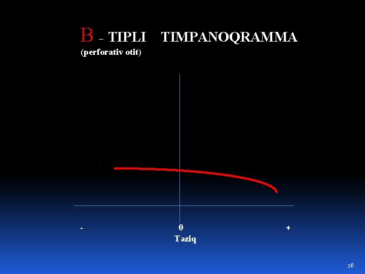 B – TIPLI TIMPANOQRAMMA (perforativ otit) - 0 Təziq + 28 