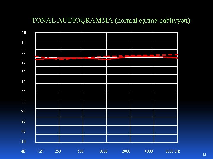 TONAL AUDIOQRAMMA (normal eşitmə qabliyyəti) -10 0 10 20 30 40 50 60 70