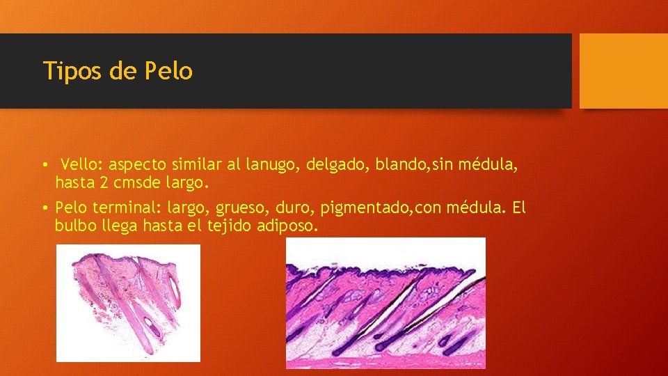 Tipos de Pelo • Vello: aspecto similar al lanugo, delgado, blando, sin médula, hasta