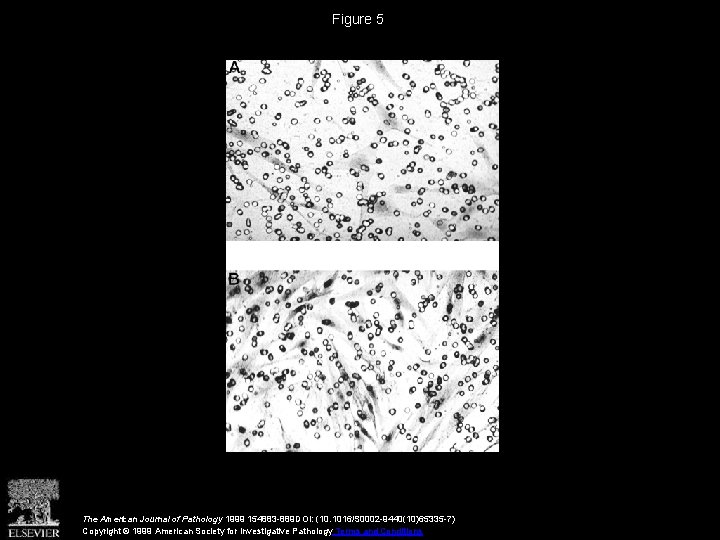 Figure 5 The American Journal of Pathology 1999 154883 -889 DOI: (10. 1016/S 0002