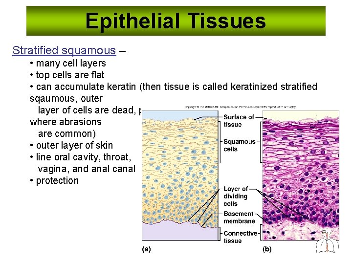 Epithelial Tissues Stratified squamous – • many cell layers • top cells are flat