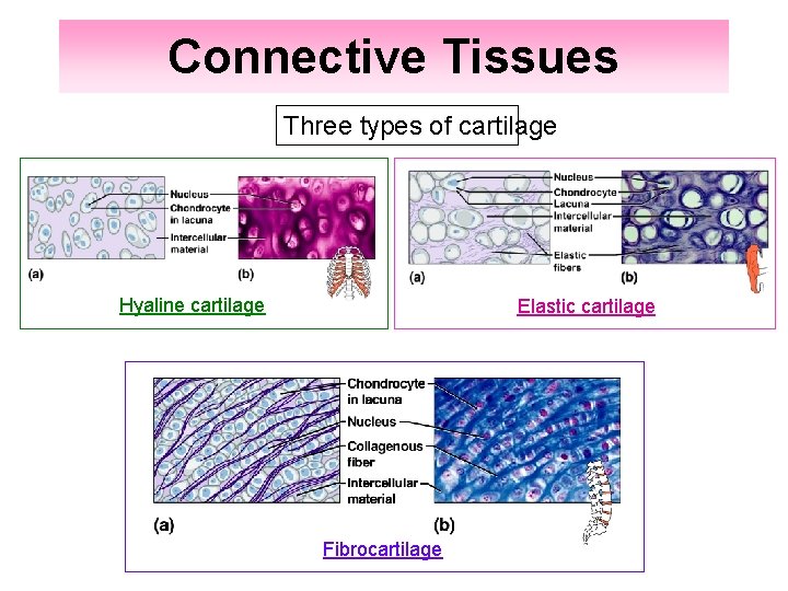 Connective Tissues Three types of cartilage Hyaline cartilage Elastic cartilage Fibrocartilage 