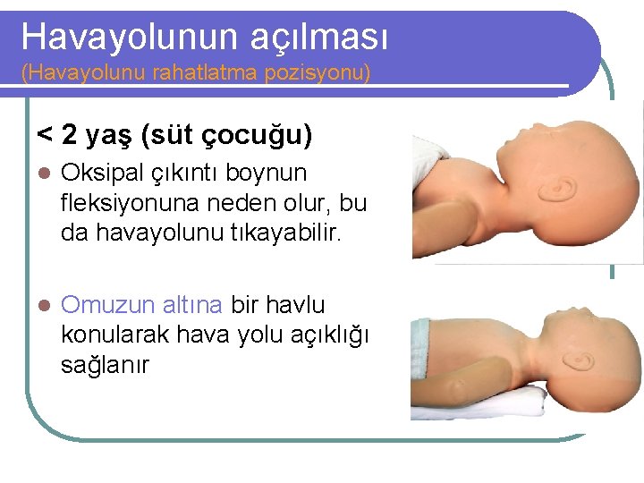 Havayolunun açılması (Havayolunu rahatlatma pozisyonu) < 2 yaş (süt çocuğu) l Oksipal çıkıntı boynun