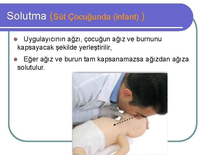 Solutma (Süt Çocuğunda (infant) ) Uygulayıcının ağzı, çocuğun ağız ve burnunu kapsayacak şekilde yerleştirilir,