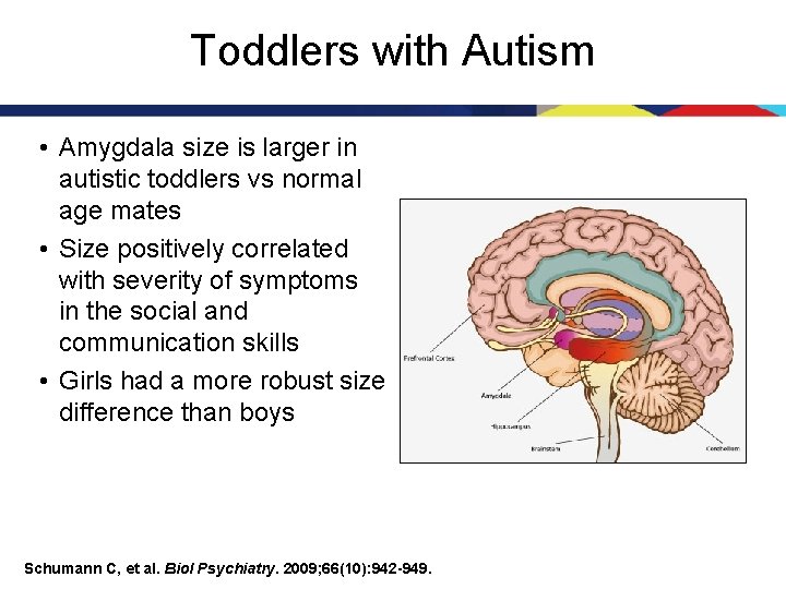 Toddlers with Autism • Amygdala size is larger in autistic toddlers vs normal age