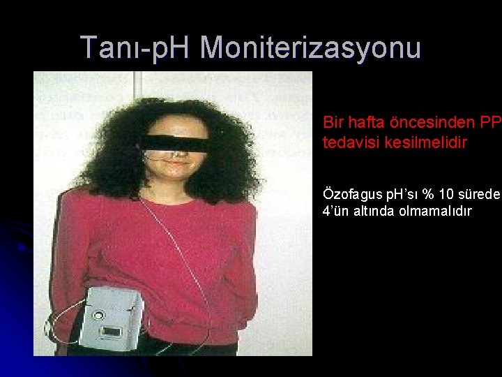 Tanı-p. H Moniterizasyonu Bir hafta öncesinden PP tedavisi kesilmelidir Özofagus p. H’sı % 10