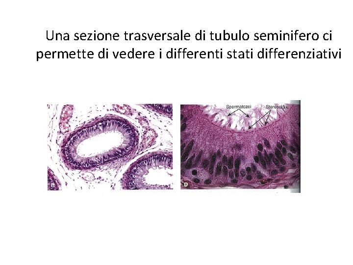 Una sezione trasversale di tubulo seminifero ci permette di vedere i differenti stati differenziativi