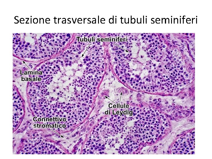 Sezione trasversale di tubuli seminiferi 