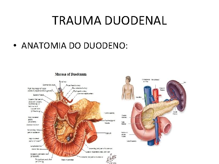 TRAUMA DUODENAL • ANATOMIA DO DUODENO: 