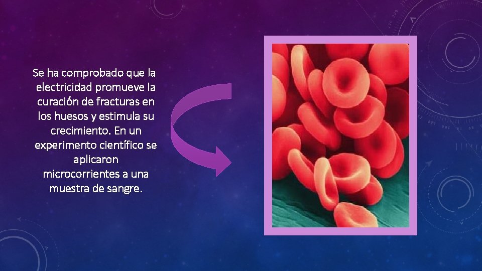 Se ha comprobado que la electricidad promueve la curación de fracturas en los huesos