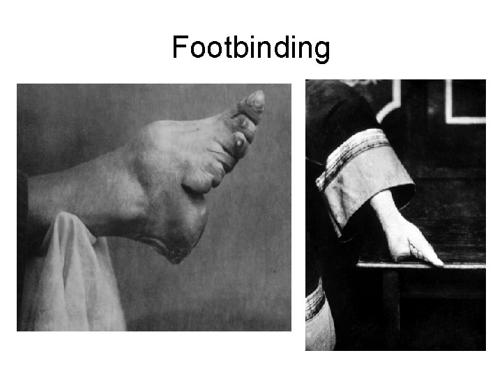 Footbinding 