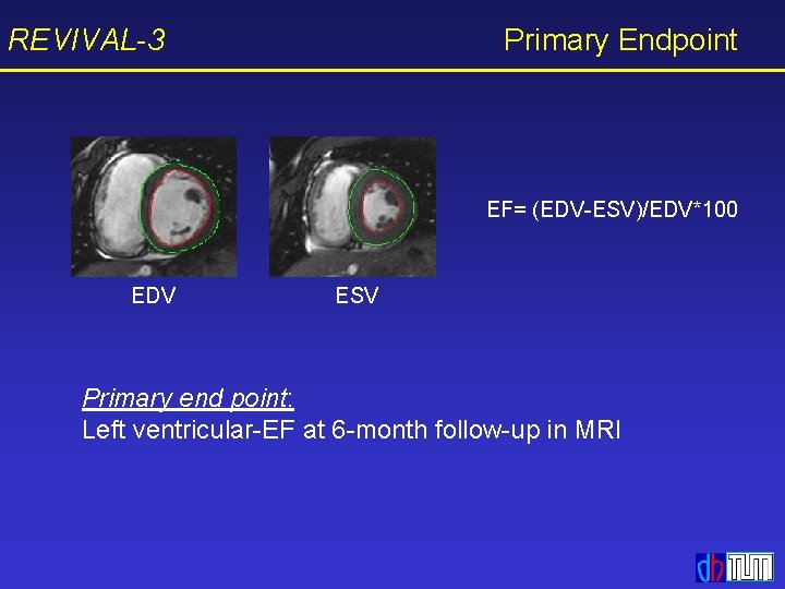 REVIVAL-3 Primary Endpoint EF= (EDV-ESV)/EDV*100 EDV ESV Primary end point: Left ventricular-EF at 6