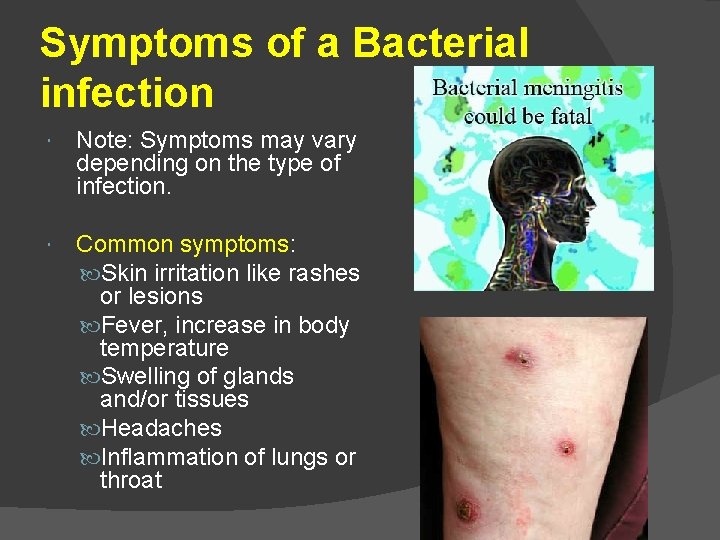 Symptoms of a Bacterial infection Note: Symptoms may vary depending on the type of