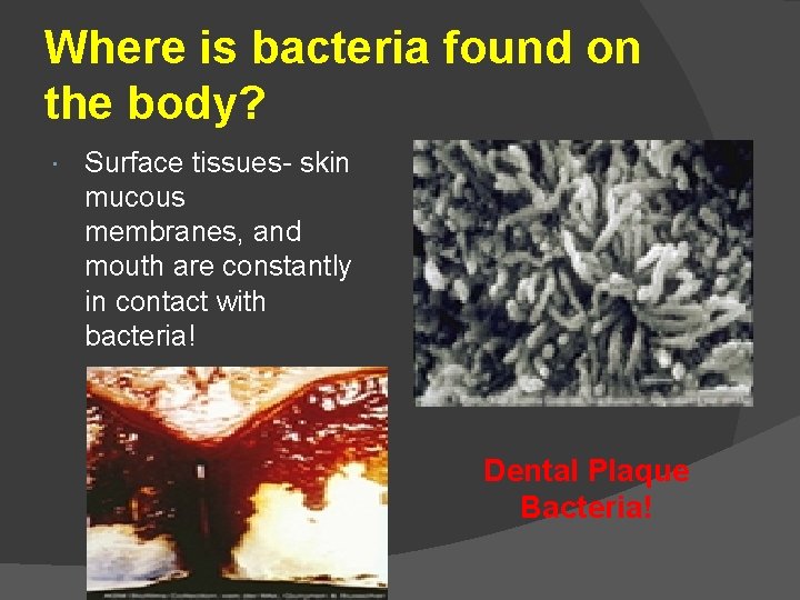 Where is bacteria found on the body? Surface tissues- skin mucous membranes, and mouth