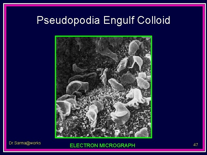 Pseudopodia Engulf Colloid Dr. Sarma@works ELECTRON MICROGRAPH 47 