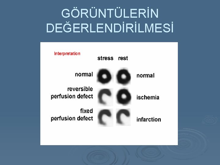 GÖRÜNTÜLERİN DEĞERLENDİRİLMESİ 