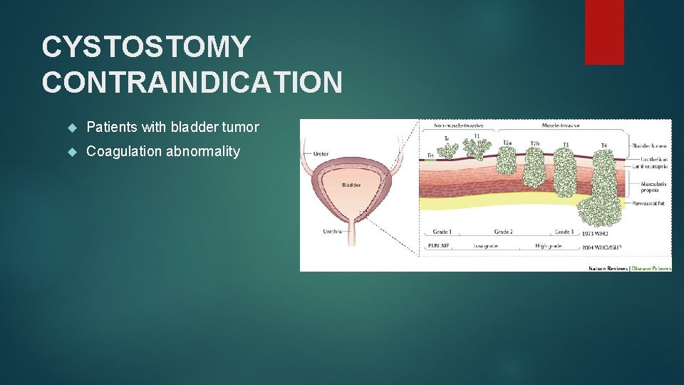 CYSTOSTOMY CONTRAINDICATION Patients with bladder tumor Coagulation abnormality 