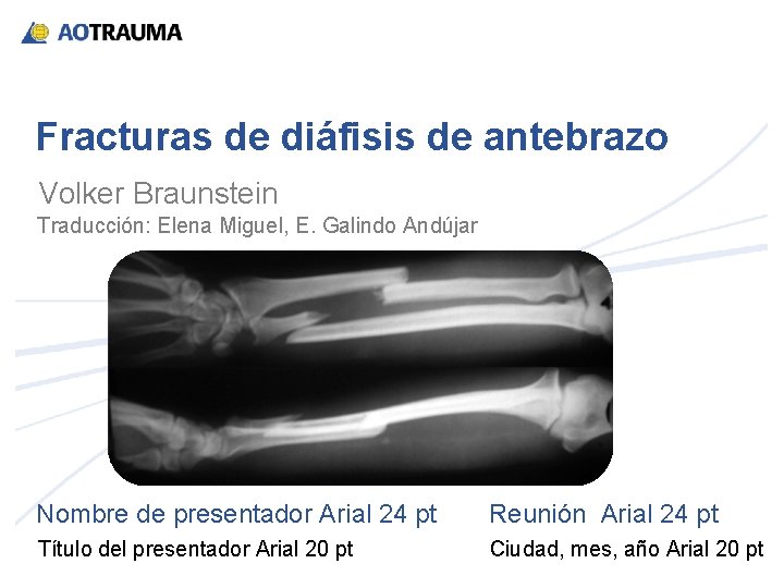 Fracturas de diáfisis de antebrazo Volker Braunstein Traducción: Elena Miguel, E. Galindo Andújar Nombre