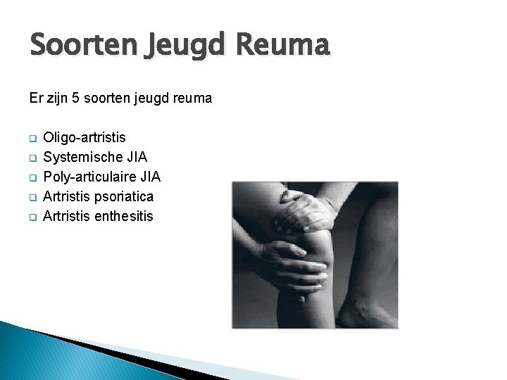 Soorten Jeugd Reuma Er zijn 5 soorten jeugd reuma q q q Oligo-artristis Systemische