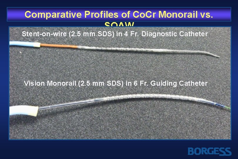 Comparative Profiles of Co. Cr Monorail vs. SOAW Stent-on-wire (2. 5 mm SDS) in