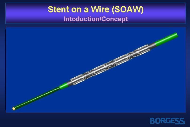 Stent on a Wire (SOAW) Intoduction/Concept Ø Balloon on wire (e. g. , ACE)