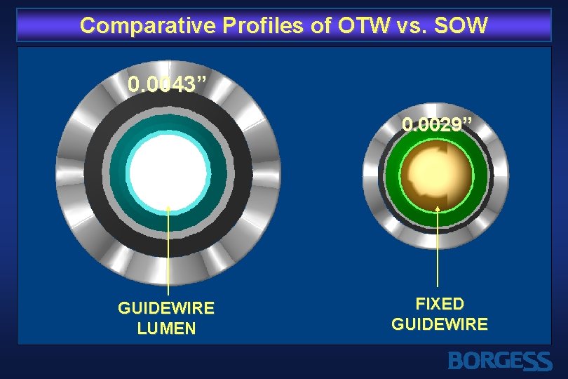 Comparative Profiles of OTW vs. SOW 0. 0043” 0. 0029” GUIDEWIRE LUMEN FIXED GUIDEWIRE
