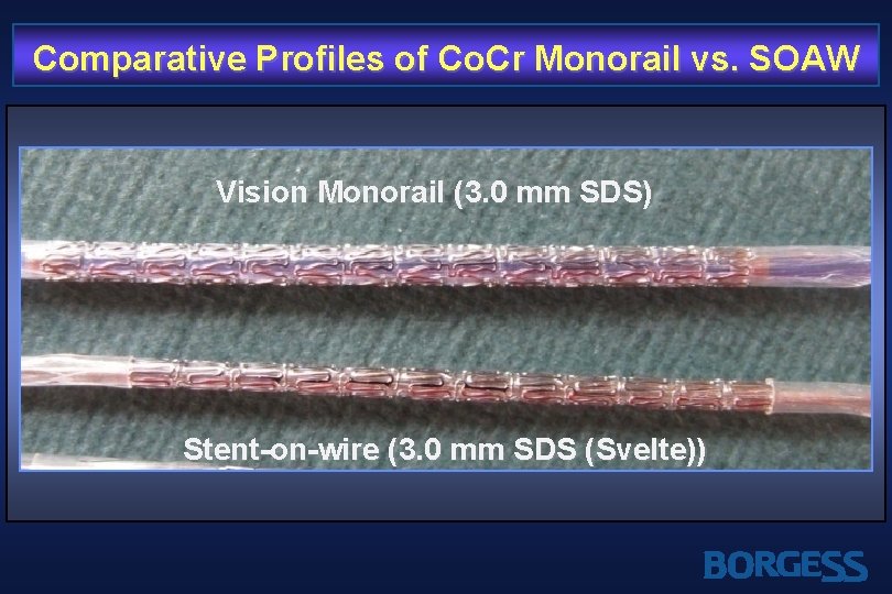 Comparative Profiles of Co. Cr Monorail vs. SOAW Vision Monorail (3. 0 mm SDS)