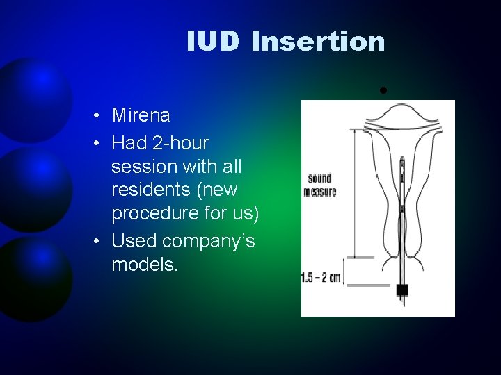 IUD Insertion • • Mirena • Had 2 -hour session with all residents (new