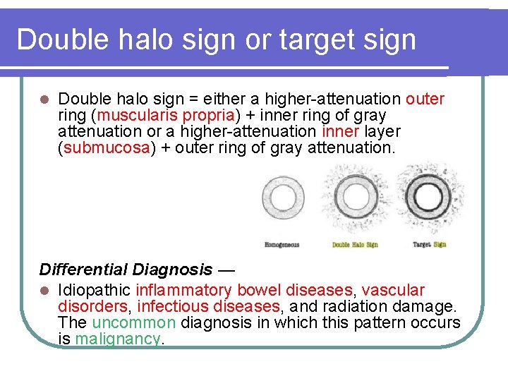 Double halo sign or target sign l Double halo sign = either a higher-attenuation