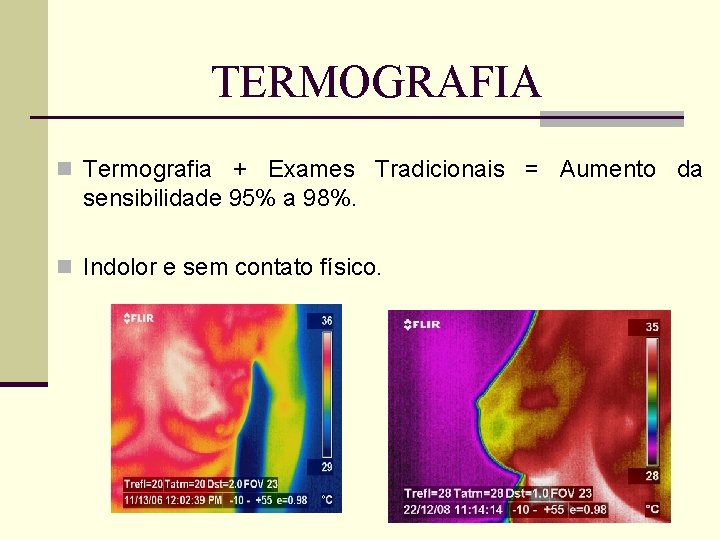 TERMOGRAFIA n Termografia + Exames Tradicionais = Aumento da sensibilidade 95% a 98%. n