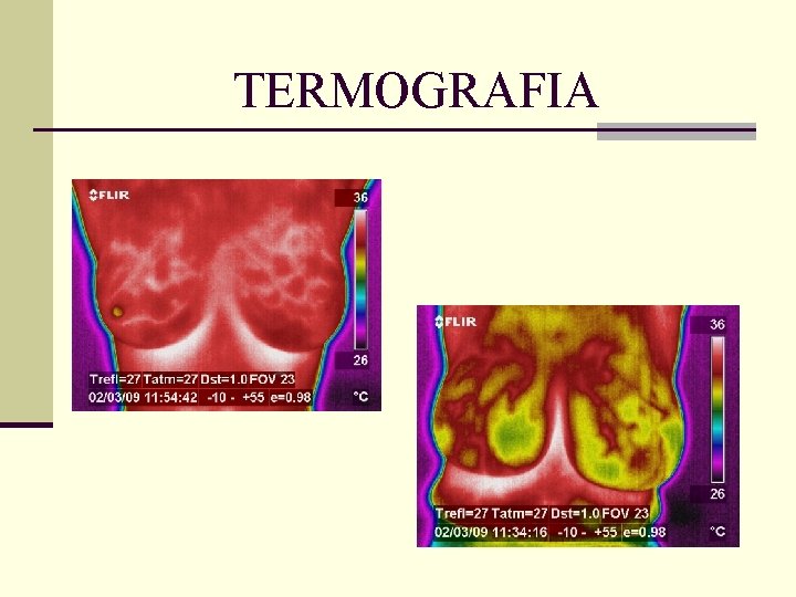 TERMOGRAFIA 