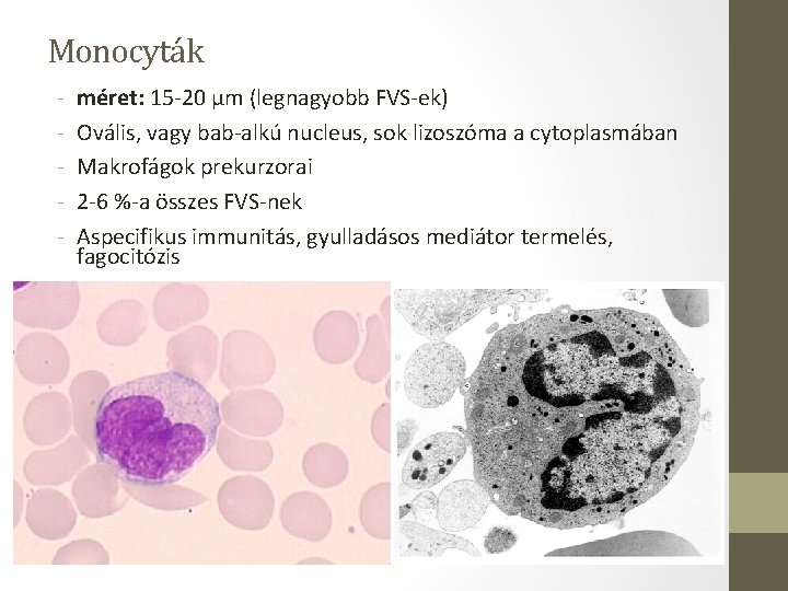 Monocyták - méret: 15 -20 µm (legnagyobb FVS-ek) Ovális, vagy bab-alkú nucleus, sok lizoszóma