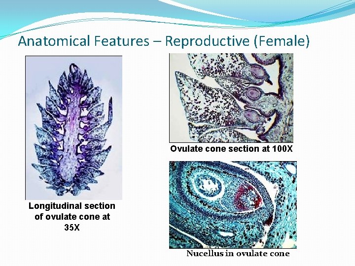 Anatomical Features – Reproductive (Female) Ovulate cone section at 100 X Longitudinal section of