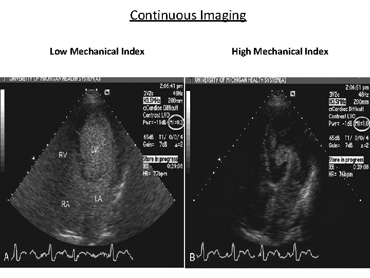 Continuous Imaging Low Mechanical Index High Mechanical Index 