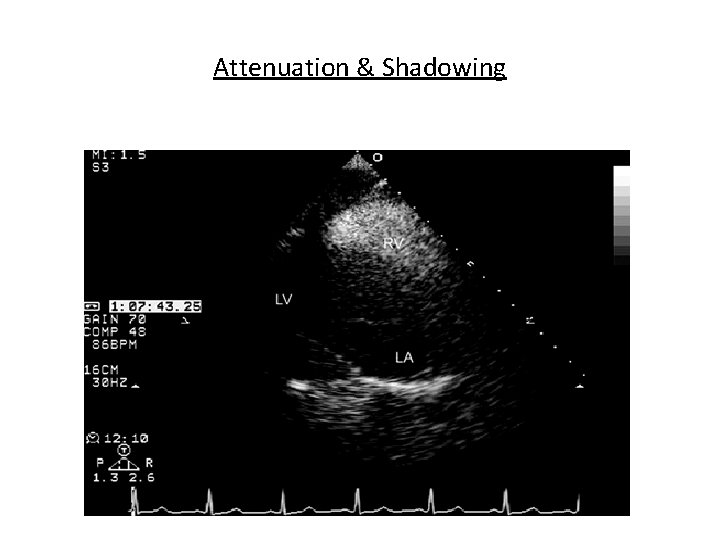 Attenuation & Shadowing 