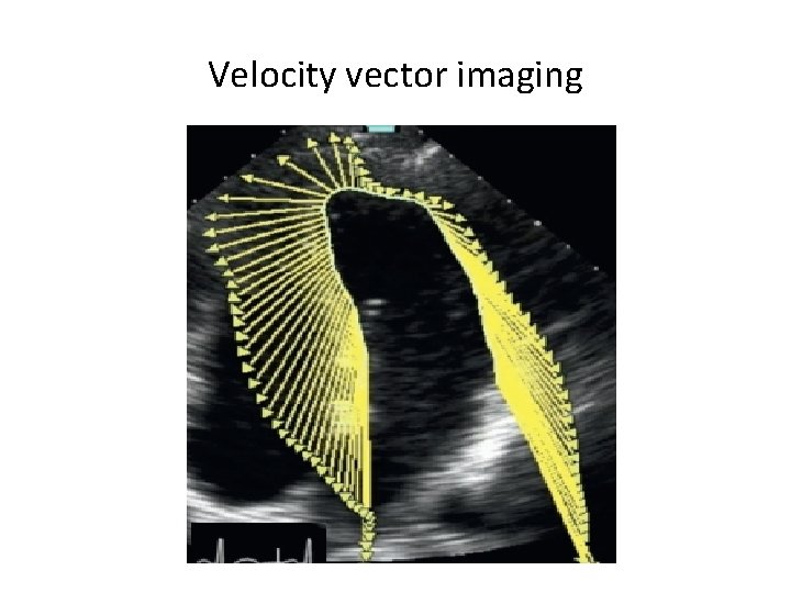 Velocity vector imaging 