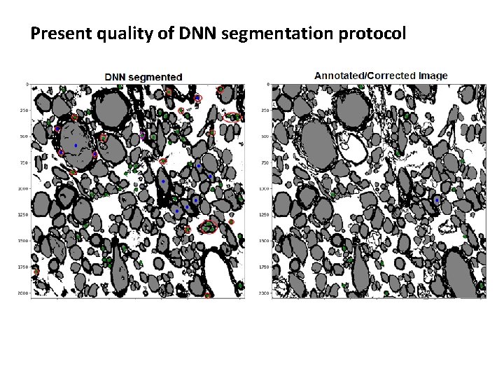 Present quality of DNN segmentation protocol Present quality of DNN segmentation protocol