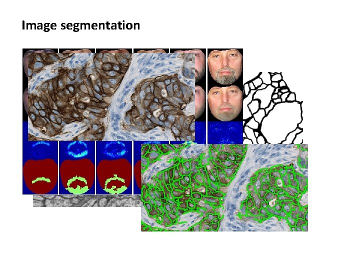 Image segmentation Image segmentation